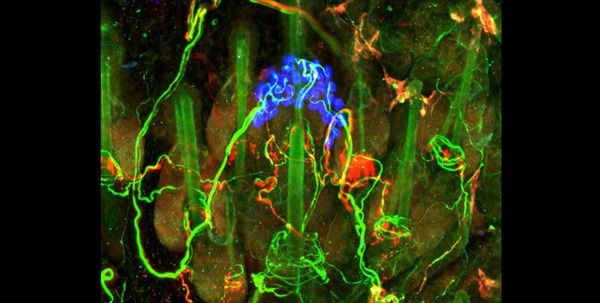 The endings of sensory neurons that detect touch in the skin. Image: Ginty lab