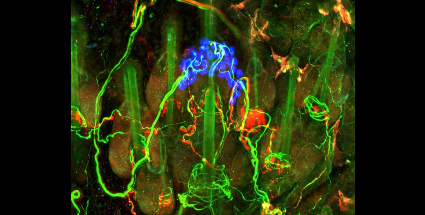 The endings of sensory neurons that detect touch in the skin. Image: Ginty lab
