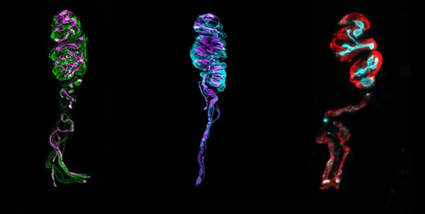 Human Meissner corpuscles. Image: Ginty lab